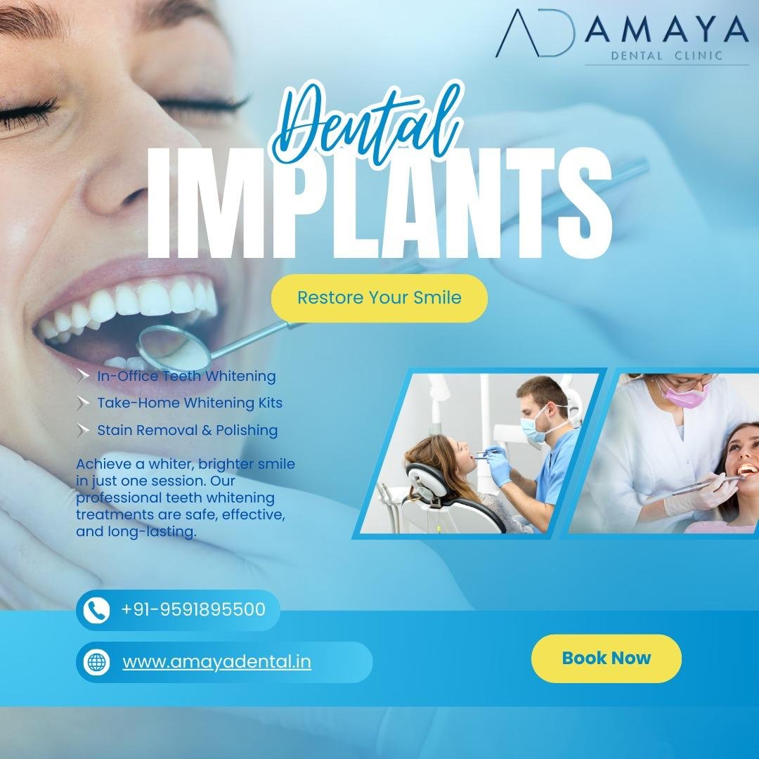 https://offers.amaya-dental.com/wp-content/uploads/2025/06/WhatsApp-Image-2025-06-22-at-16.22.13.jpeg